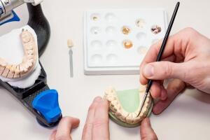 Nuestro laboratorio de prótesis dentales en Javea