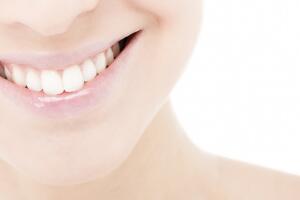 Preguntas frecuentes sobre implantes dentales