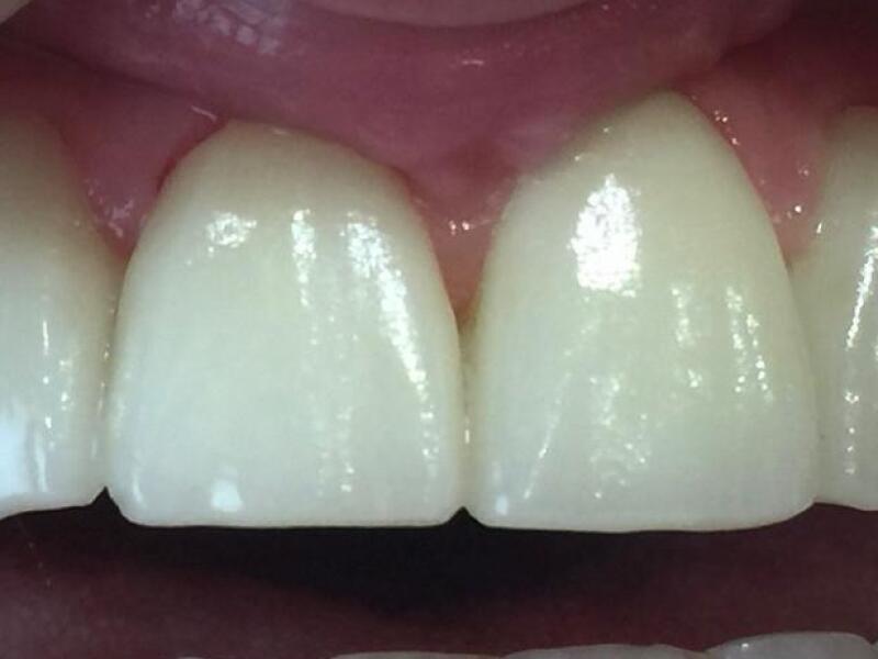 After image
