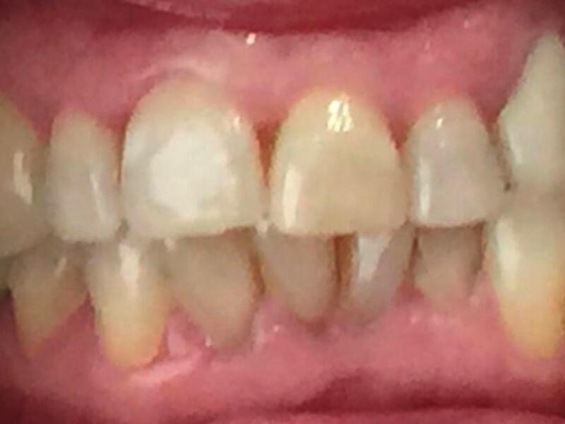 Before image