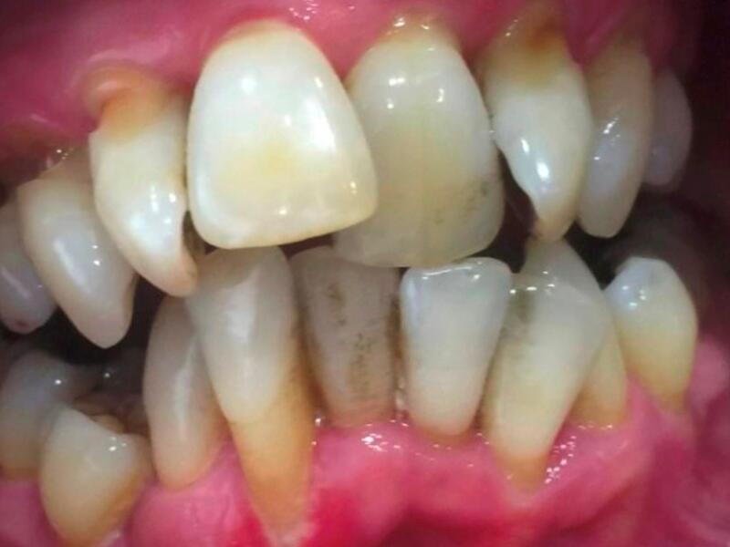 Before image