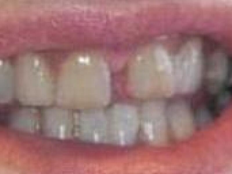 Before image