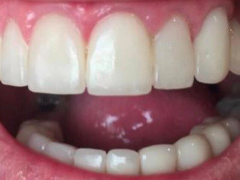 After image