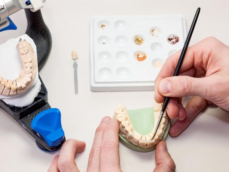 Nuestro laboratorio de prótesis dentales en Javea