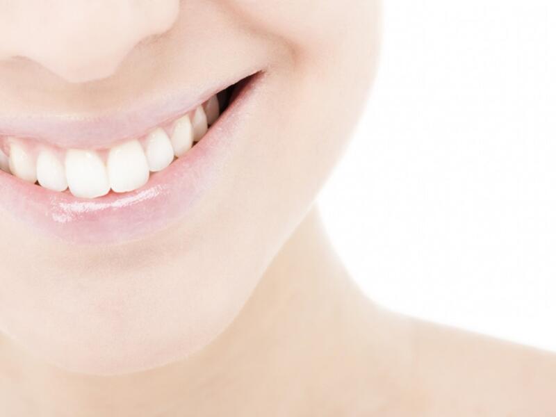Preguntas frecuentes sobre implantes dentales
